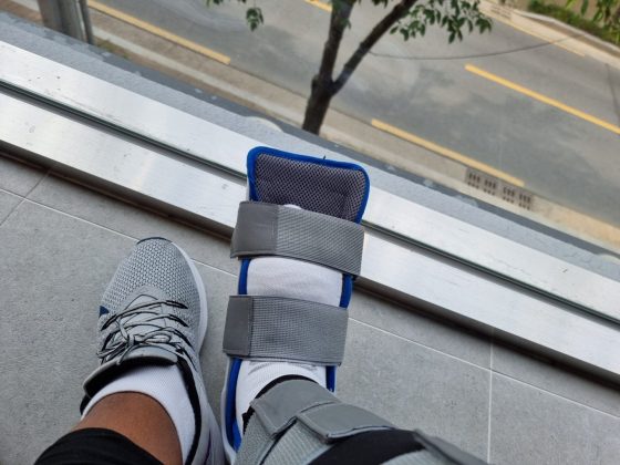 foot surgery at Yeungnam University Medical Center in Daegu Korea